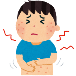 乳酸菌の効果その④、アトピー性皮膚炎（アレルギー）の改善効果を解説！おすすめの乳酸菌サプリ